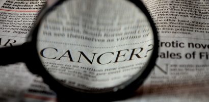 The Protein Interaction Between Interleukin-6 and APOBEC3 Provides Insight into Liver Cancer Treatment