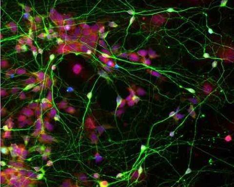 Human neural stem cells (shown in red), reprogrammed originally from adult skin cells, differentiate efficiently into brain cells (shown in green), after being cultured with star-shaped cells called astrocytes.