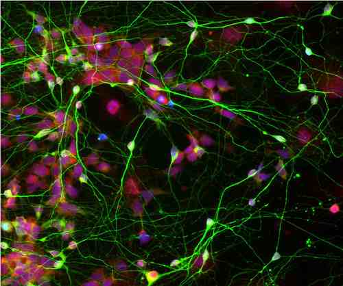 Human neural stem cells (shown in red), reprogrammed originally from adult skin cells, differentiate efficiently into brain cells (shown in green), after being cultured with star-shaped cells called astrocytes.
