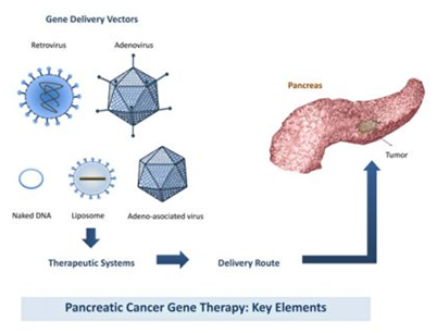 Pancreatic Cancer Gene Therapy Key Elements