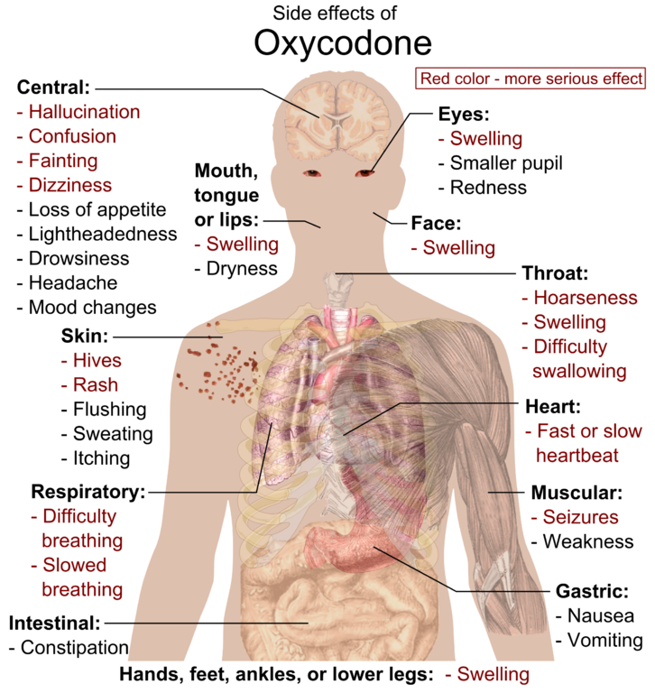 Side effects of Oxycodone