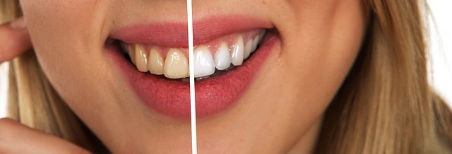 Make Your Teeth White and Beautiful