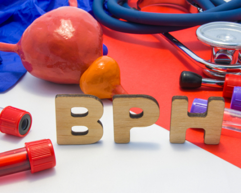 Benign Prostatic Hyperplasia or BPH