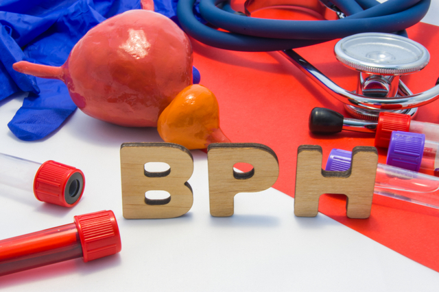 Benign Prostatic Hyperplasia or BPH