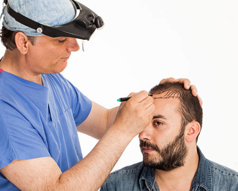 Latest Developments in Hair Transplant Technology