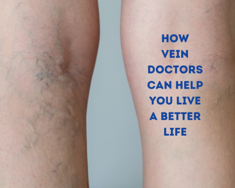 How Vein Doctors Can Help You Live a Better Life