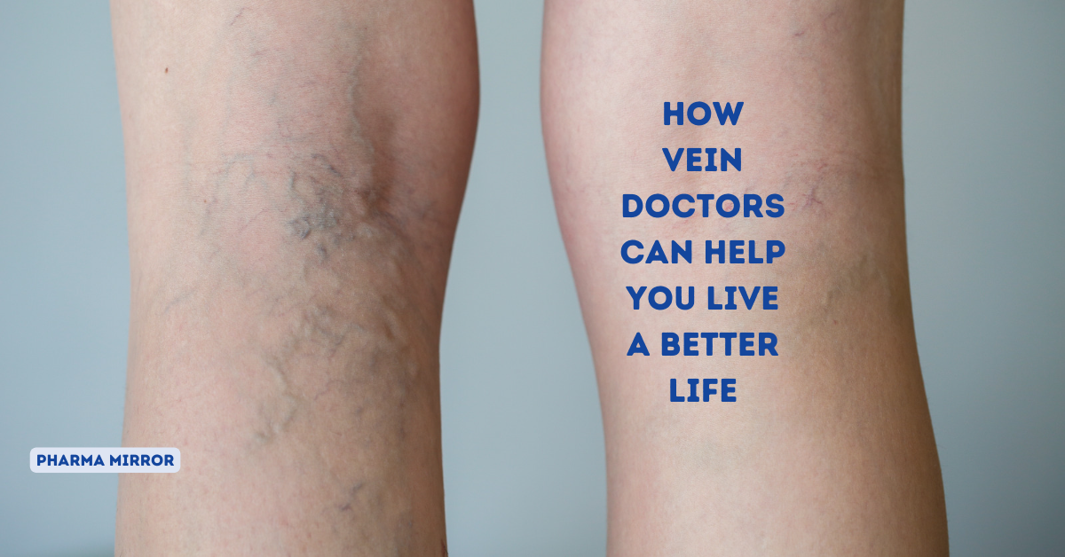 How Vein Doctors Can Help You Live a Better Life