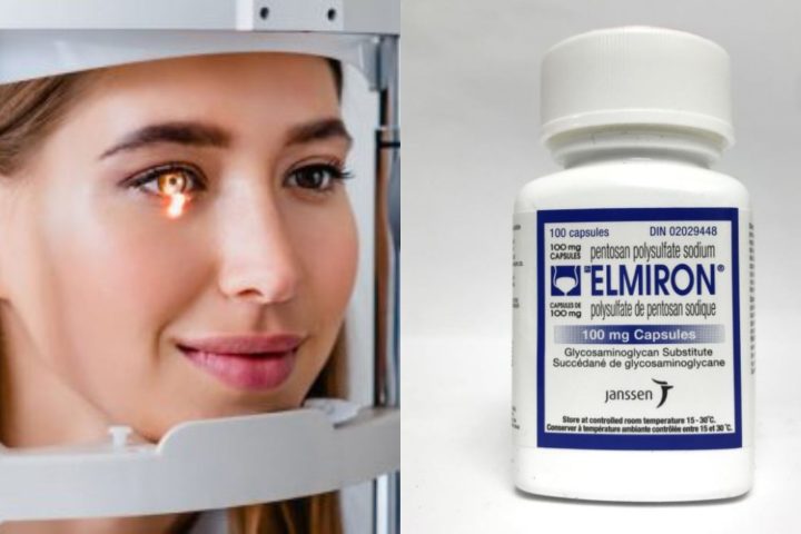 Can You Sue Your Doctor for Blindness Caused by Elmiron?