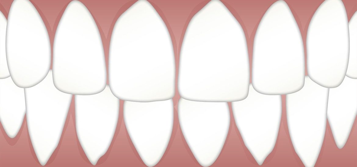 Periodontal Disease