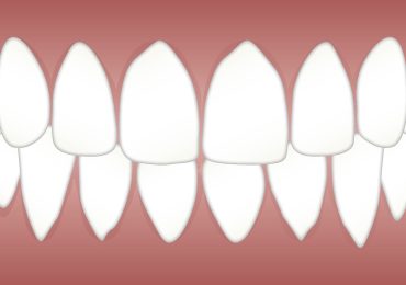 Periodontal Disease