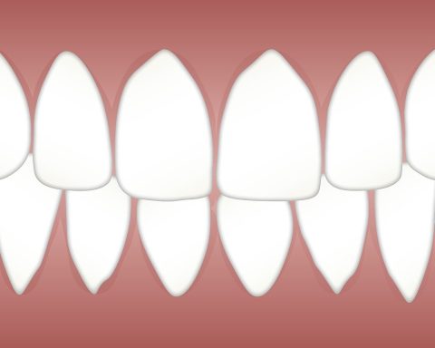 Periodontal Disease