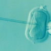 ivf