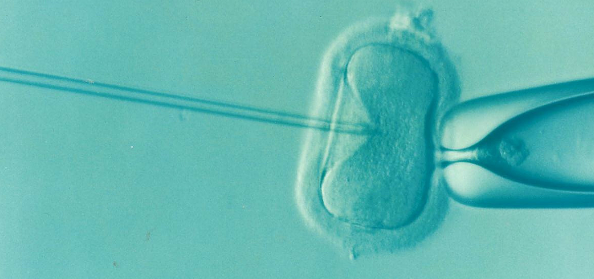 ivf