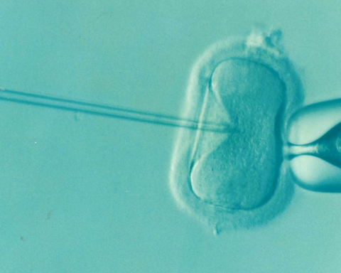 ivf