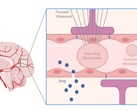 Creative Bioarray Develops Comprehensive Portfolio for In Vitro and In Vivo Blood-Brain Barrier Assay